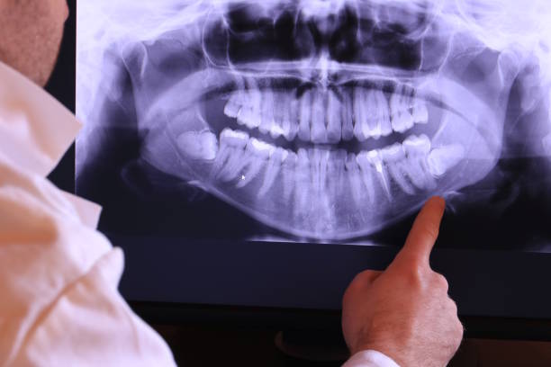 Best Holiday Emergency Dentist in Chamblee, GA