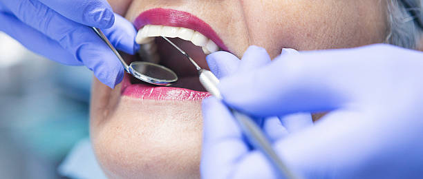 Best Emergency Root Canal Treatment in Chamblee, GA